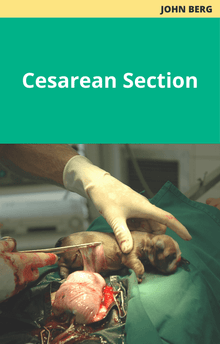John Berg Cesarean Section